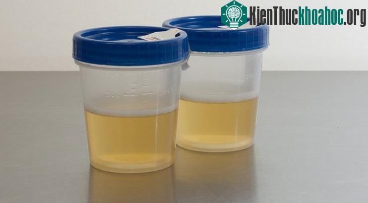 Pin nhiên liệu vi sinh mới sử dụng vi khuẩn để chuyển hóa nước tiểu thông thường thành điện năng.