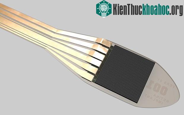 Con chip thế hệ thứ hai cấy vào mắt Lewis. (Ảnh: PA).