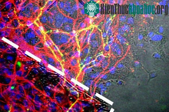 Bước tiến mới cho các bệnh Parkinson và Alzheimer.