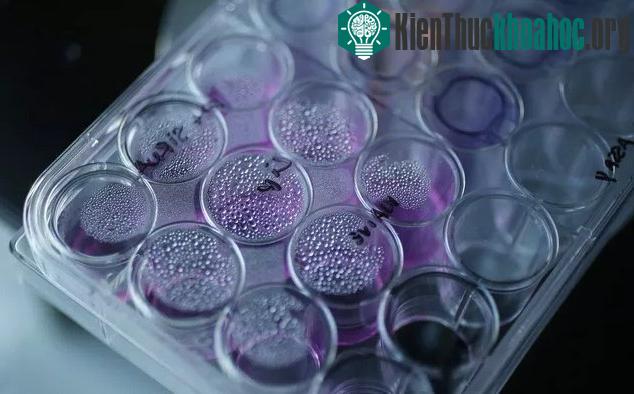 Một khay chứa các tế bào ung thư trên một kính hiển vi điện tử.