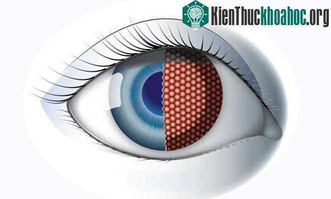 Ảnh minh họa. (Nguồn: medicalxpress.com)