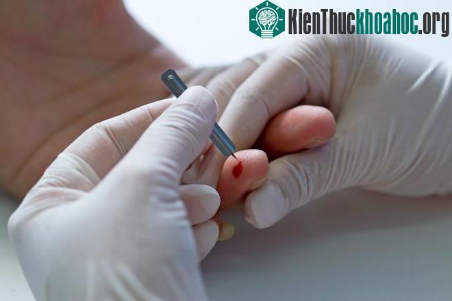 Ảnh minh họa. (Nguồn: medicaldaily.com)