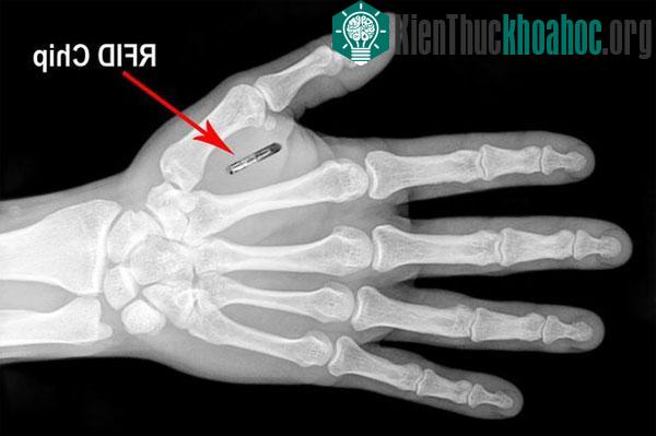 Cấy chip vào tay nhân viên để mở khóa văn phòng