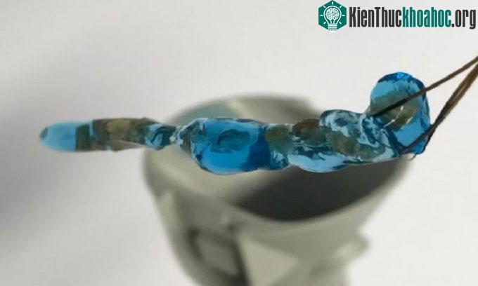 Khối hydrogel với những mẩu sỏi thận ở bên trong.