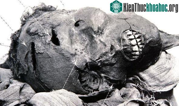 Gương mặt méo méo, vặn vẹo của vị pharaoh Ai Cập cổ đại.