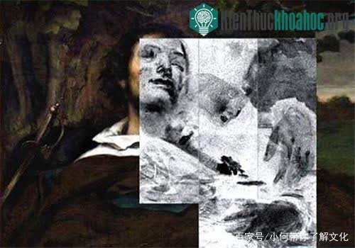 Chi tiết người phụ nữ nằm trong lòng người đàn ông khi chụp X-quang.