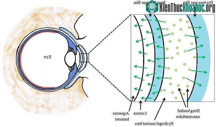 Loại kính áp tròng này cho phép các phân tử thuốc có hình dạng nhất định đi qua đó.