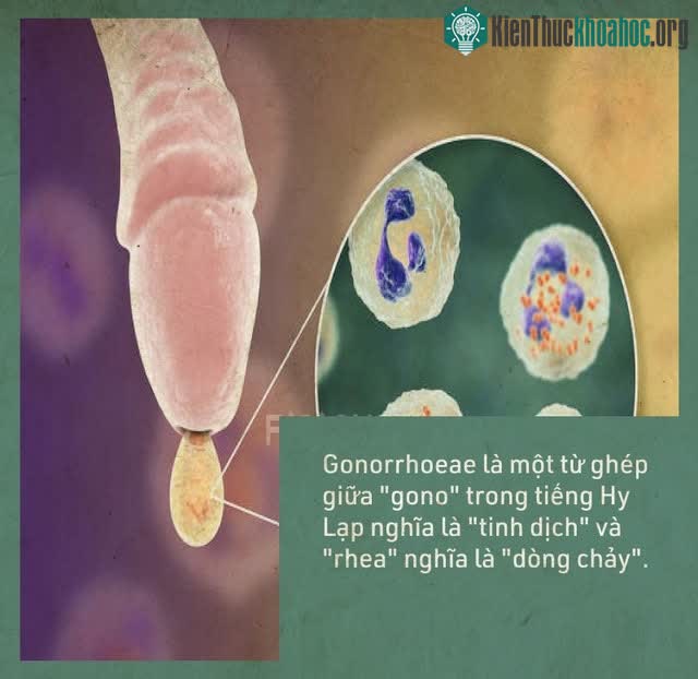 Gonorrhoeae