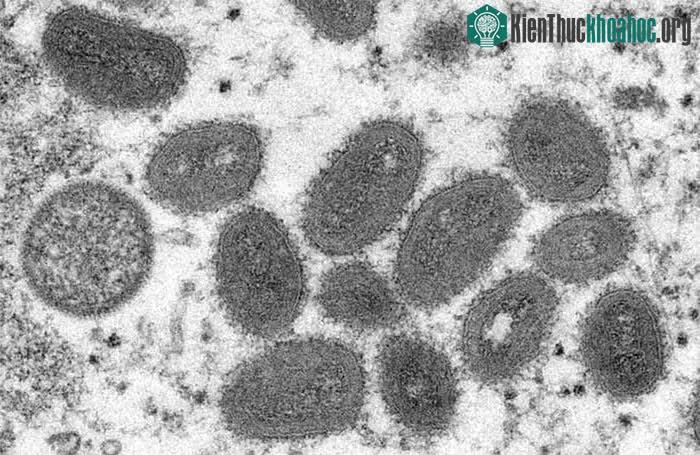Hình ảnh virus đậu mùa khỉ dưới kính hiển vi điện tử.&nbsp;