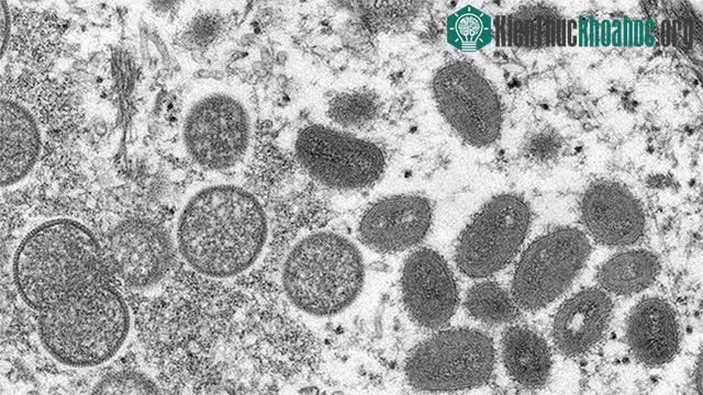 Hình ảnh virus đậu mùa khỉ dưới kính hiển vi điện tử.&nbsp;