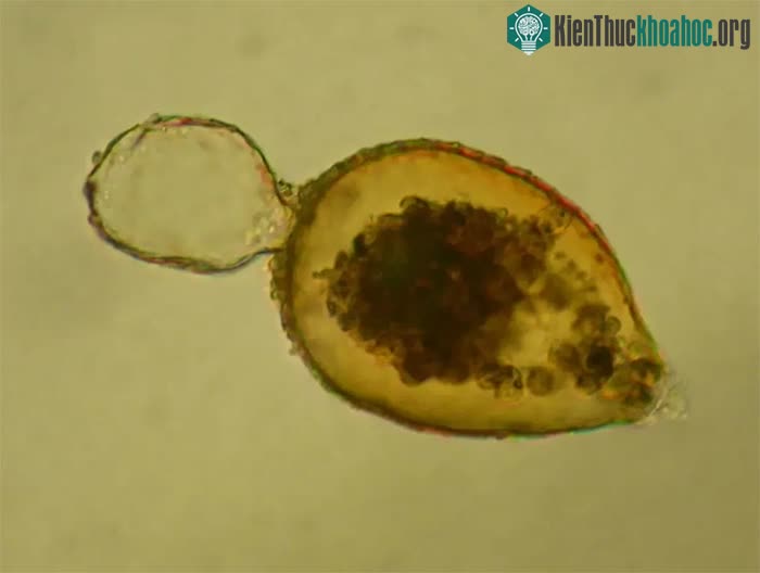 Resigella bilocularis dưới kính hiển vi.