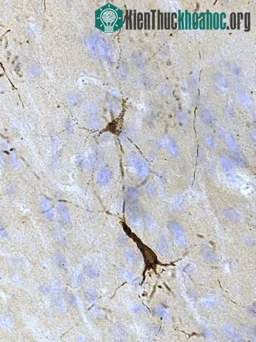 Hóa ra động vật có sừng khi húc nhau cũng bị... chấn thương sọ não ảnh 1
