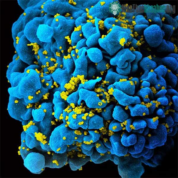 Virus HIV