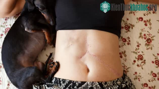 Chú chuột nhỏ bé này có thể nắm giữ chìa khóa cho một cuộc cách mạng y tế trong tương lai! ảnh 2