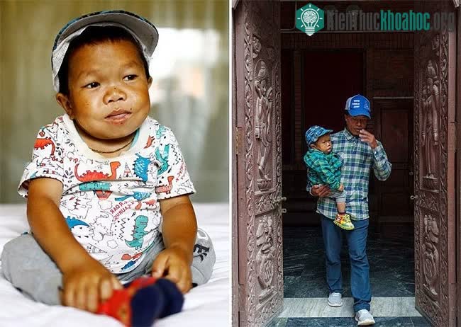Để tới được Kathmandu nhận danh hiệu, Khapangi phải nhờ người thân đưa đi và bế vào tận nơi.