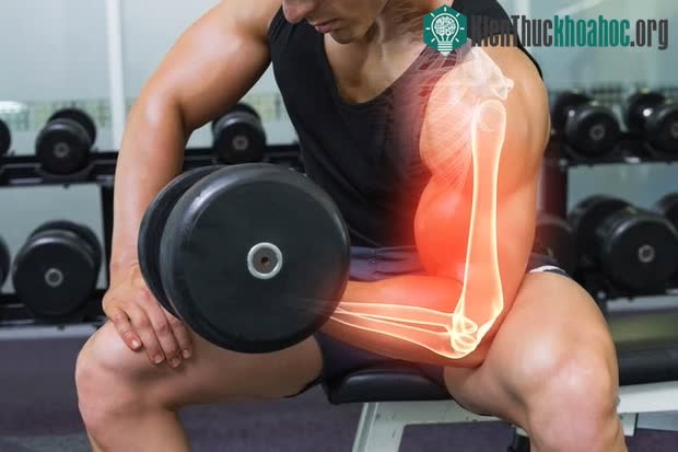 Những người có xương siêu bền "không thể bẻ gãy"