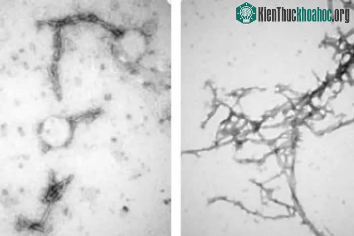 PFFNB2 liên kết chặt chẽ với các khối protein, giúp phá vỡ chúng một cách hiệu quả.