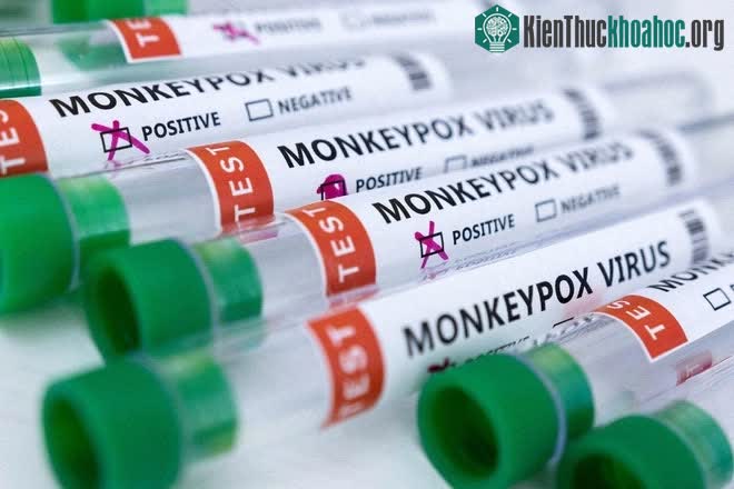 Theo Lancet, xét nghiệm xác định cả chủ và chó cùng có kết quả dương tính với bệnh đậu mùa khỉ.