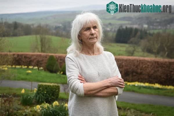 Jo Cameron, một người phụ nữ Scotland mắc bệnh không biết đau.