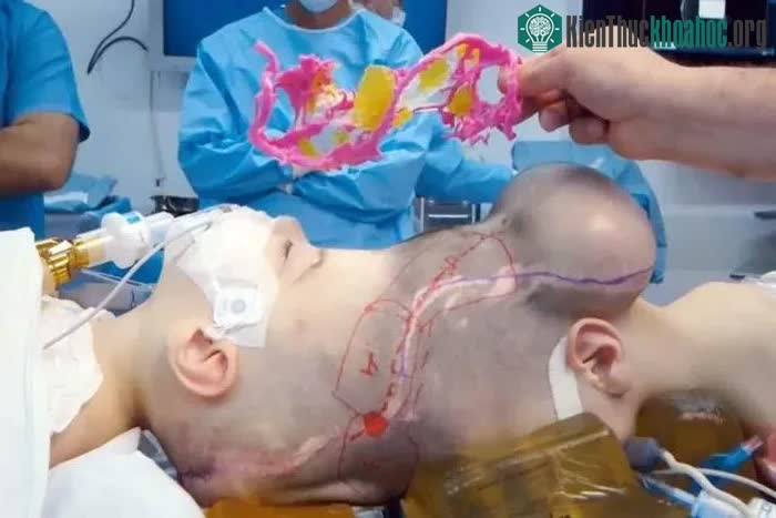 Hai bé Bernardo và Arthur Lima trước giờ phẫu thuật.
