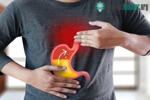 Trào ngược dạ dày