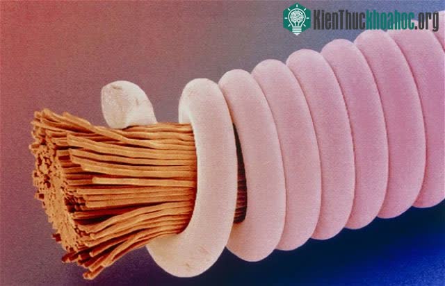 Top 25 món đồ thông dụng nhưng trông thật khác lạ dưới góc nhìn kính hiển vi ảnh 11