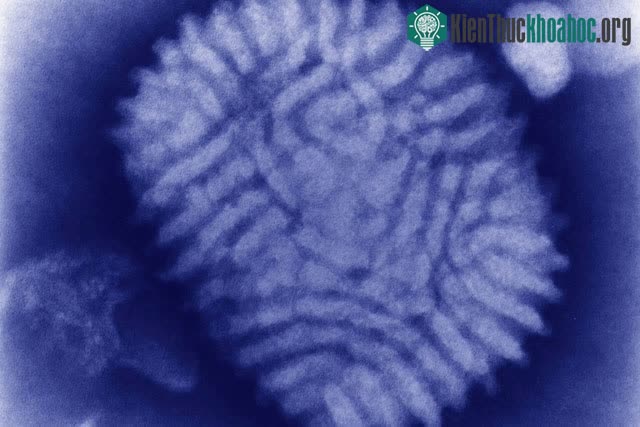 Virus Myxoma dưới ống kính hiển vi điện tử.