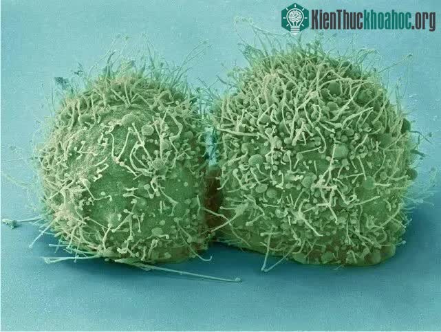 Các tế bào HeLa vừa được phân chia.