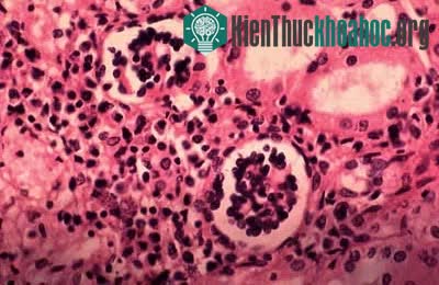 Leishmania chagasi và Leishmania donovani