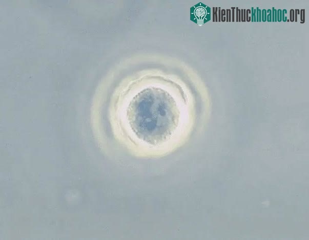 Acanthamoeba