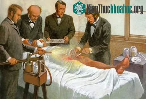 Sáng chế này đã đưa ông trở thành nhà tiên phong trong lĩnh vực y tế dự phòng