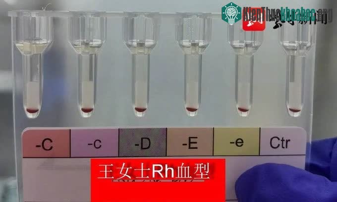 Rh-null là nhóm máu hiếm nhất trên thế giới.