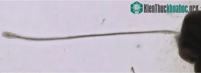 Tóc phát triển từ một trong những organoid nang tóc nuôi cấy.
