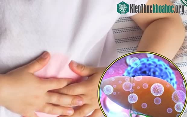 Bệnh viêm gan bí ẩn