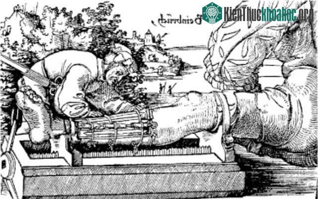 Hình minh họa việc dùng nẹp gỗ từ Gersdorf (1517).