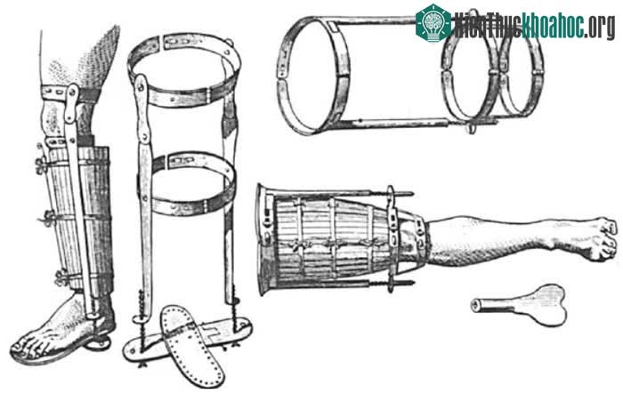 Một số hình thức nẹp gỗ băng bó vào chi bị thương đã được sử dụng từ thời cổ đại cho đến ngày nay.