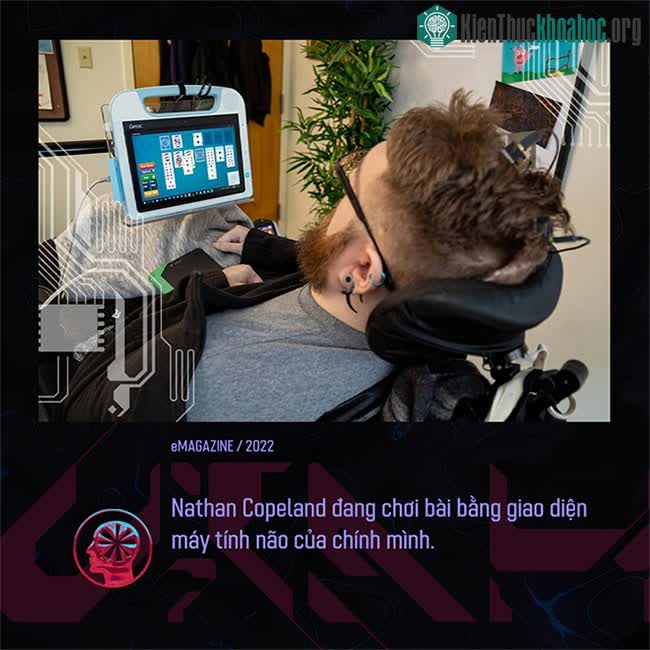 Nathan Copeland chơi bài bằng giao diện máy tính não của chính mình