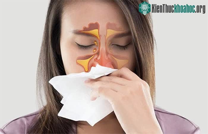 Viêm mũi dị ứng