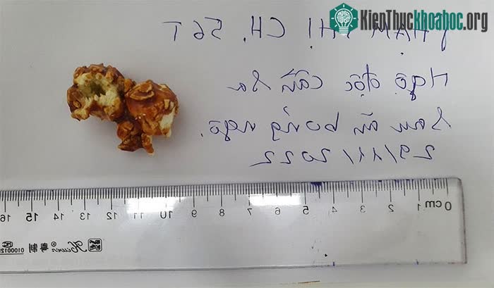 Phát hiện bánh ngọt Lazy Cakes và bỏng ngô chứa chất ma túy ảnh 1