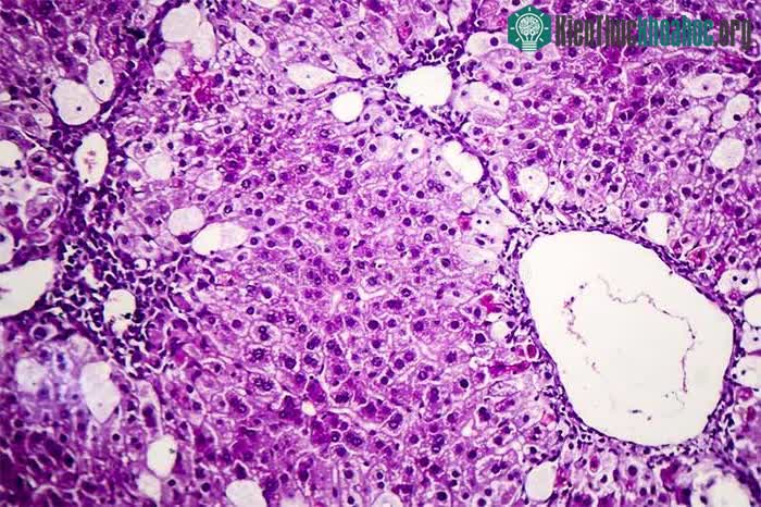 Sau khi bị đóng băng, hình ảnh của cấu trúc protein hiện lên rất rõ.