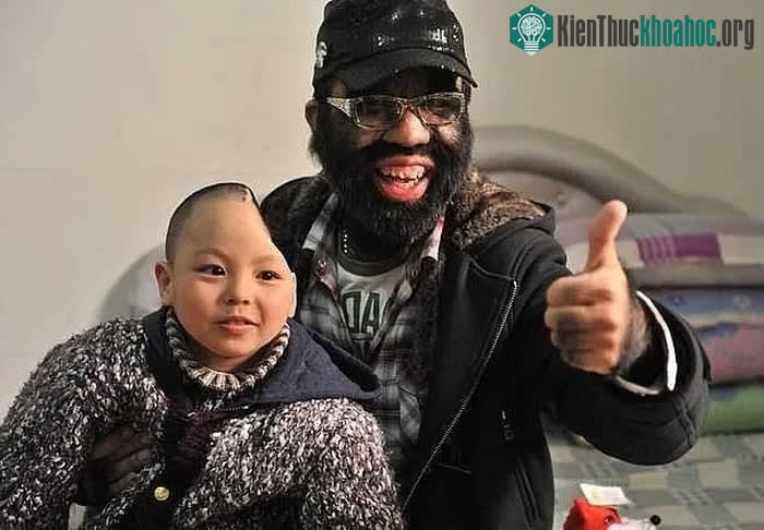 Người đàn ông nhiều lông nhất