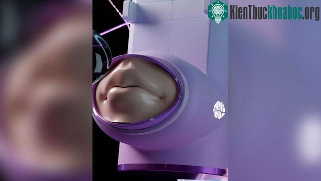 Thiết bị hôn môi xa