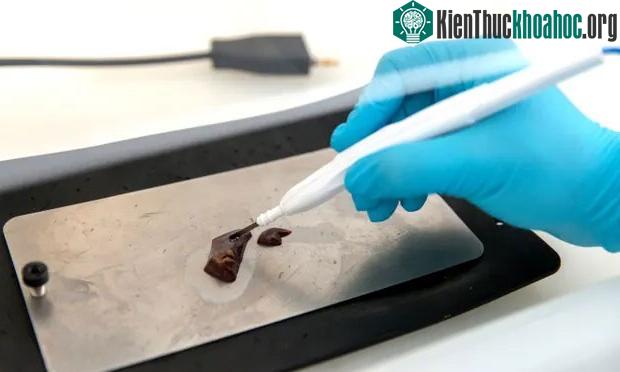 iKnife do một nhóm các nhà nghiên cứu tại Đại học Hoàng gia London phát triển.
