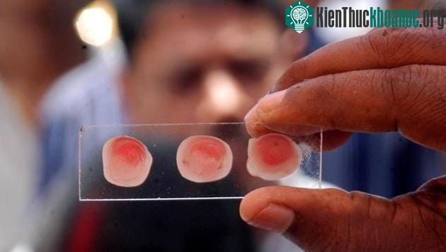 Nhóm máu có thể ảnh hưởng đến nguy cơ mắc bệnh tim mạch.