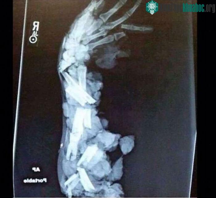 Chỉ nhìn thôi cũng cảm nhận được sự đau đớn.