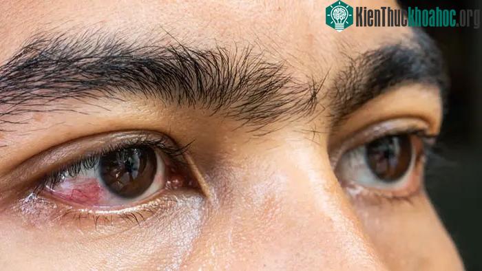 Hai mắt của người mọc ở trên mặt là kết quả của cả một quá trình tiến hóa lâu dài.