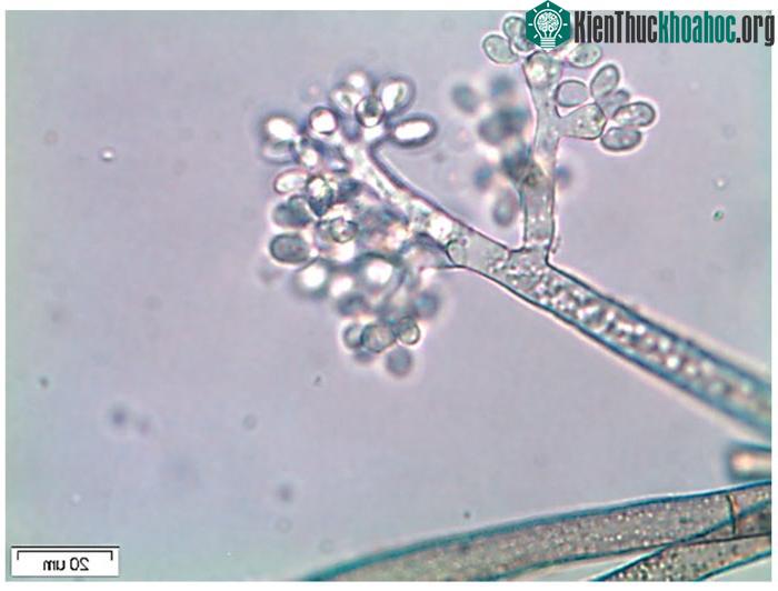 Botrytis cinerea có thể bay trong không khí và đậu trên các loại cây khác nhau.