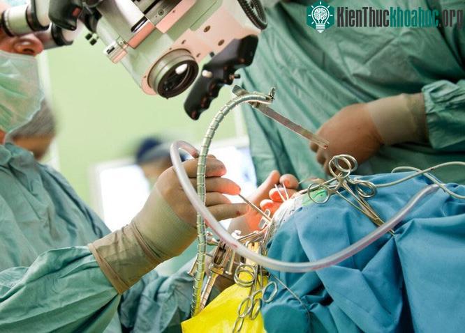 Bác sĩ phẫu thuật thần kinh