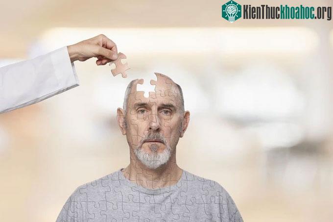 Suy nghĩ tích cực còn làm giảm đáng kể nguy cơ mắc bệnh mất trí nhớ.