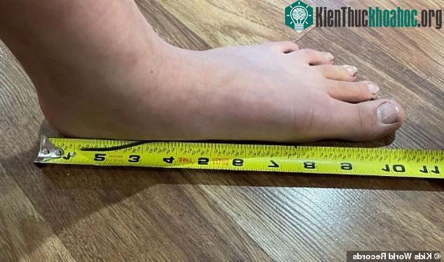 Bàn chân của Ruby đạt đến độ dài 26,7cm khi chưa đầy 10 tuổi